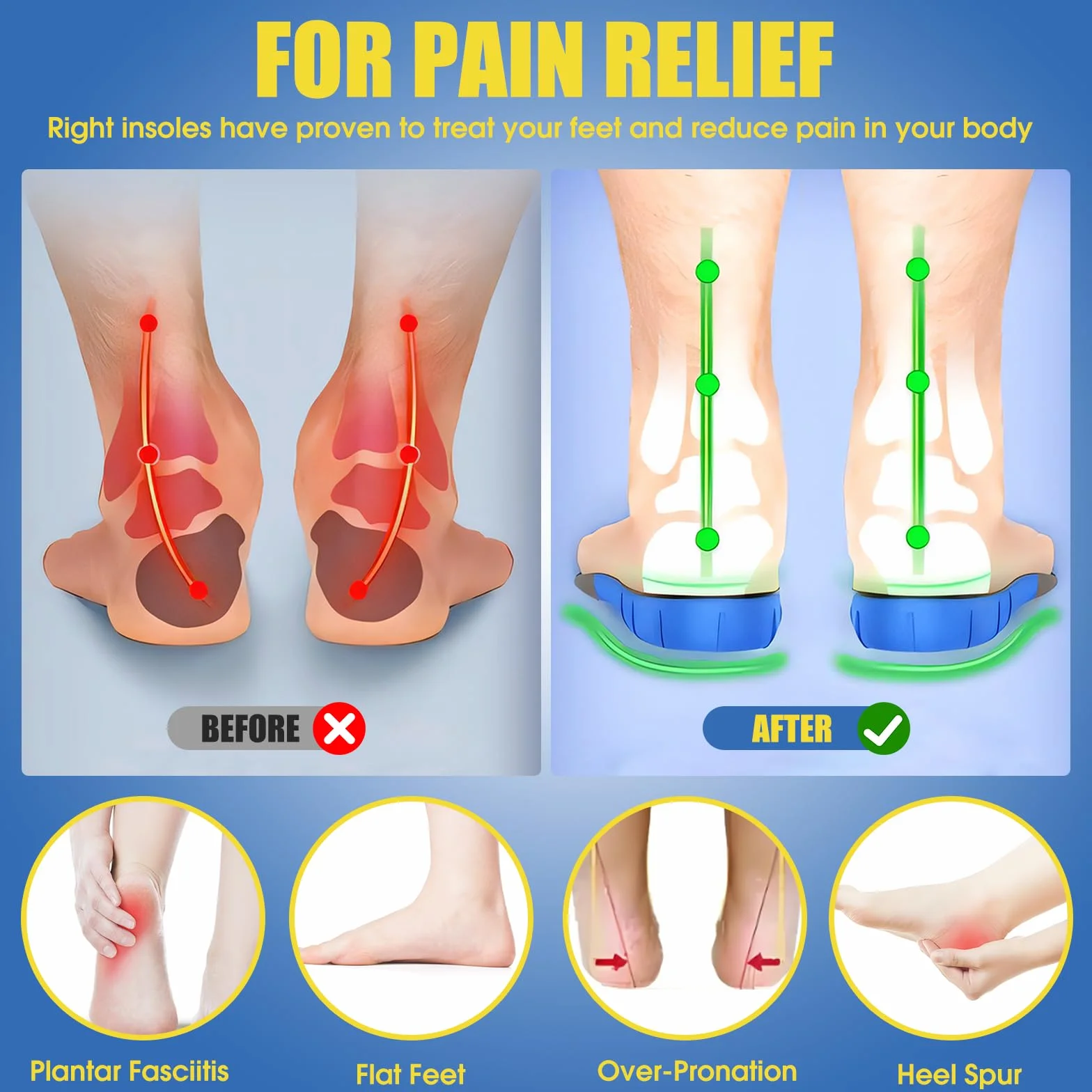 Plantillas Ortopédicas Gel para Fascitis Plantar, Hombre y Mujer, Pies Planos